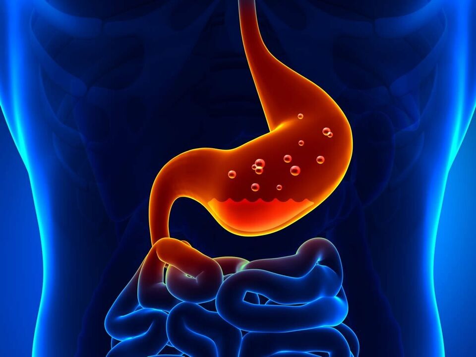 Η γαστρίτιδα είναι μια φλεγμονώδης νόσος του στομάχου που απαιτεί διατροφή